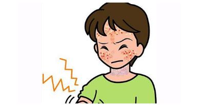      夏季皮肤发生皮炎的原因有哪些？